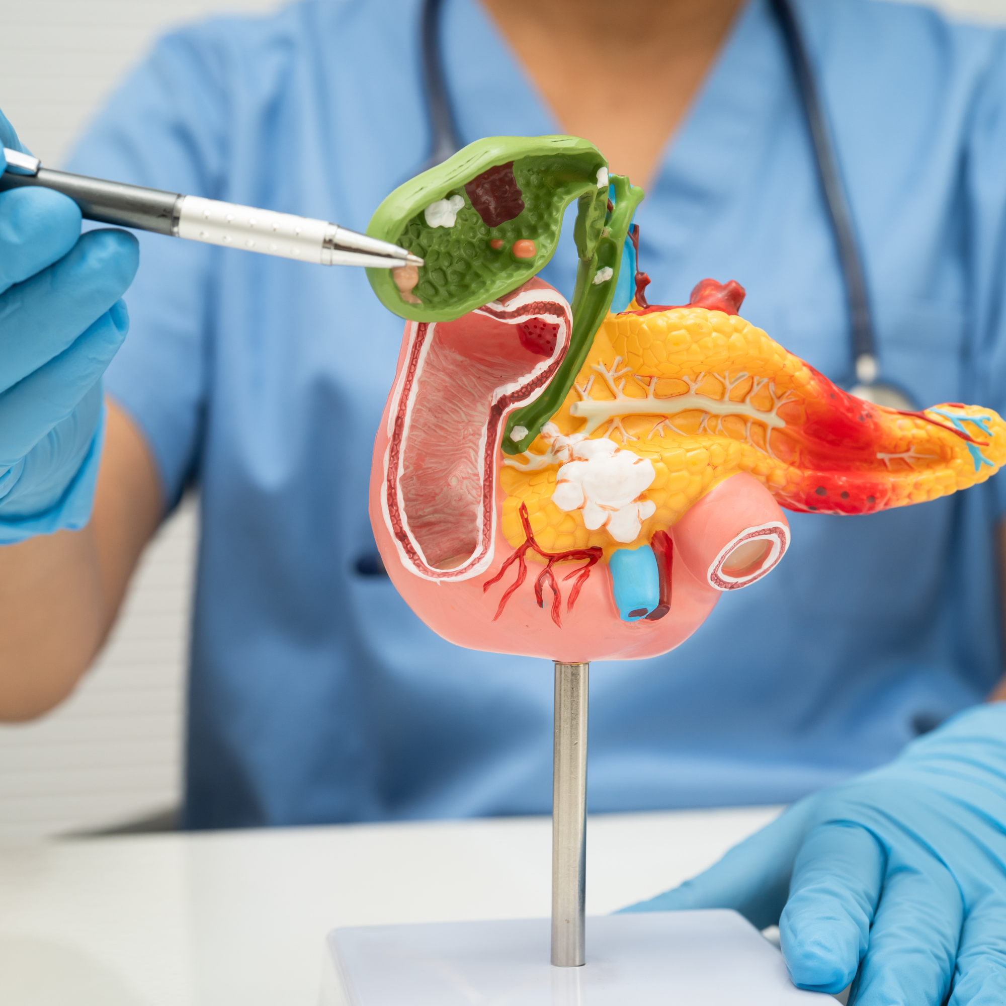 Pancreatic Support